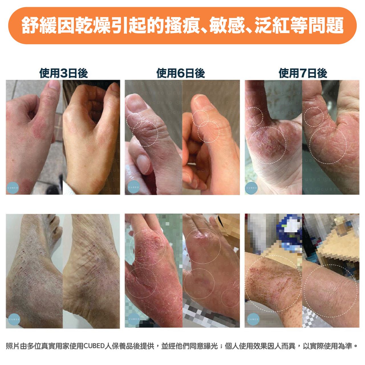 皇牌護理組合
