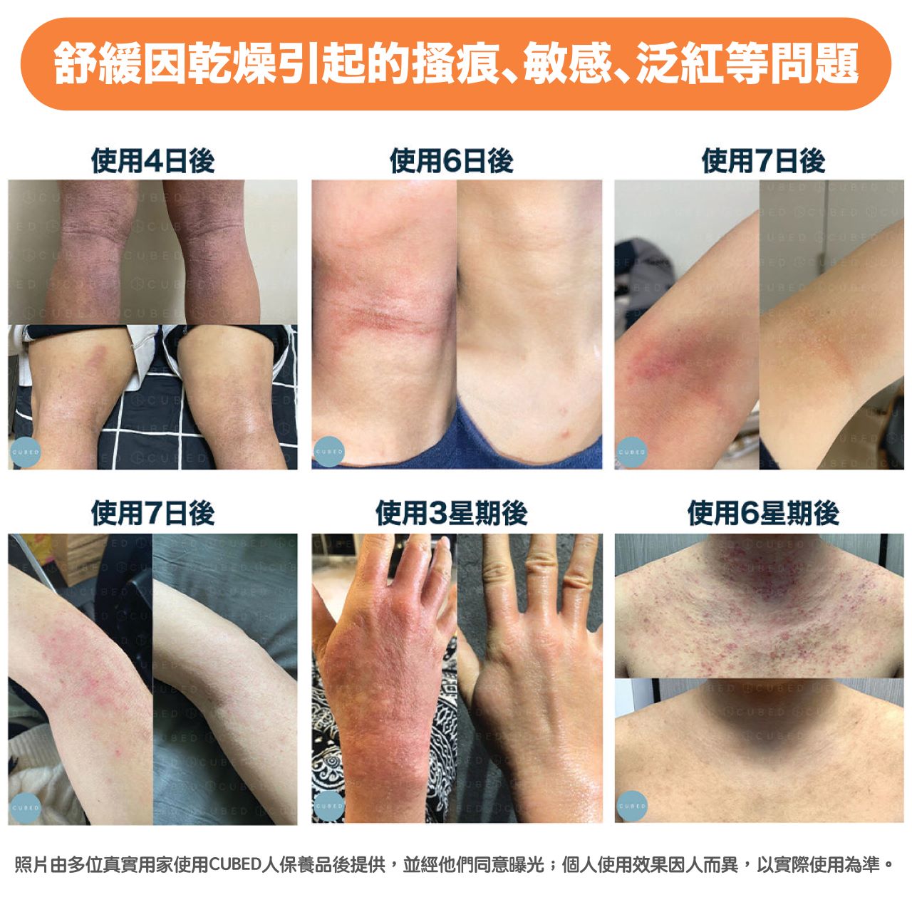 皇牌護理組合