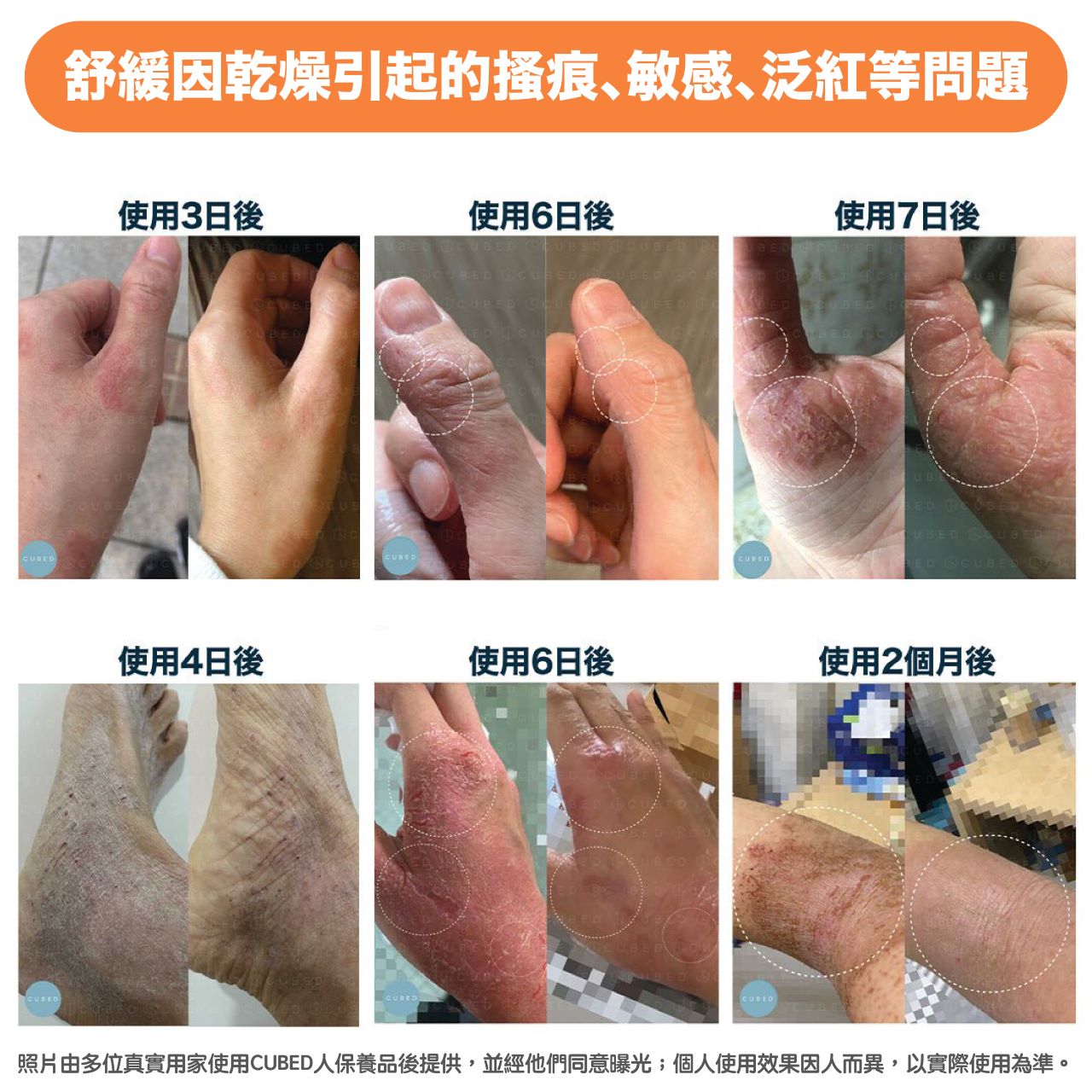 紓敏潤膚霜-敏癢肌、乾燥癢肌適用