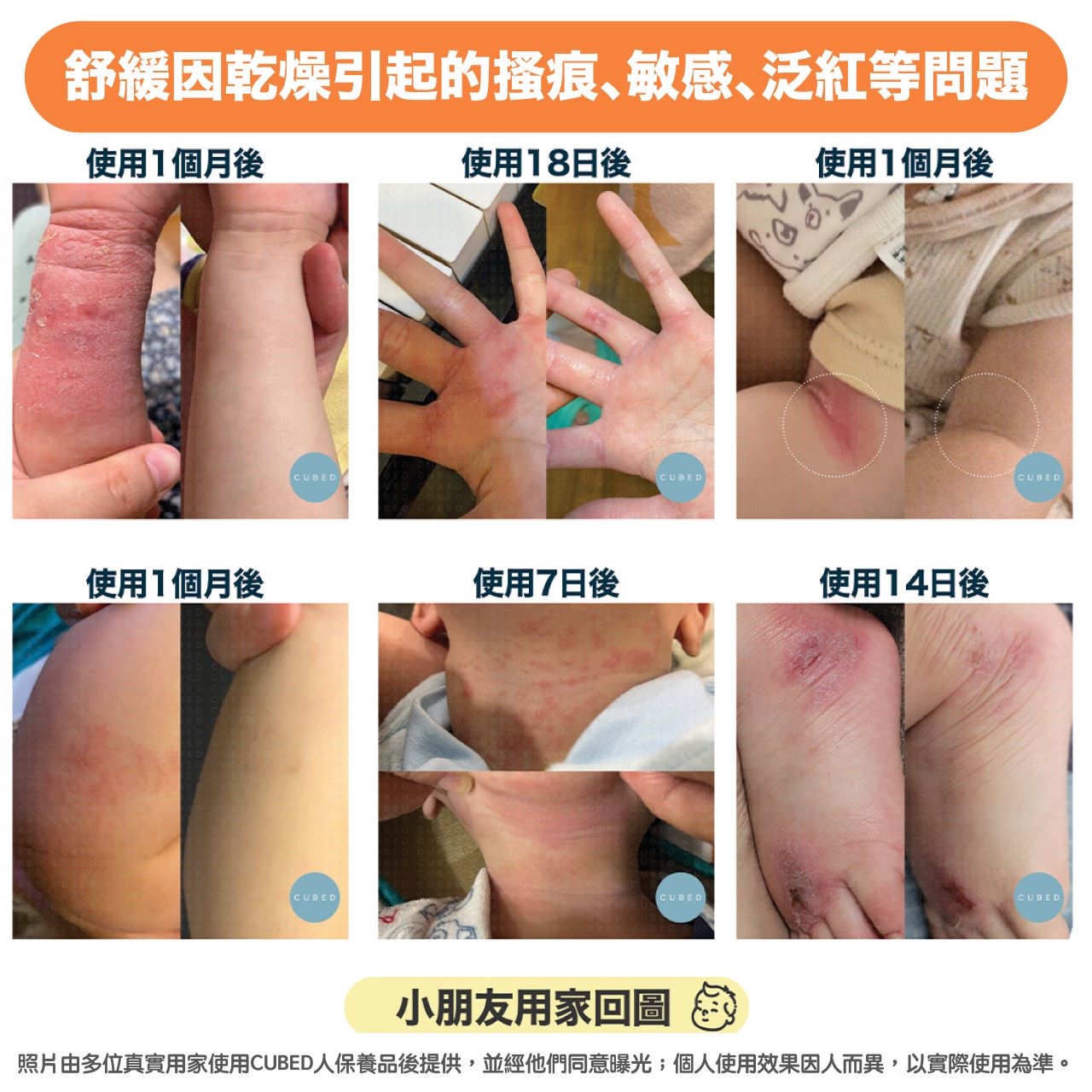 兒童問題肌擊護組合