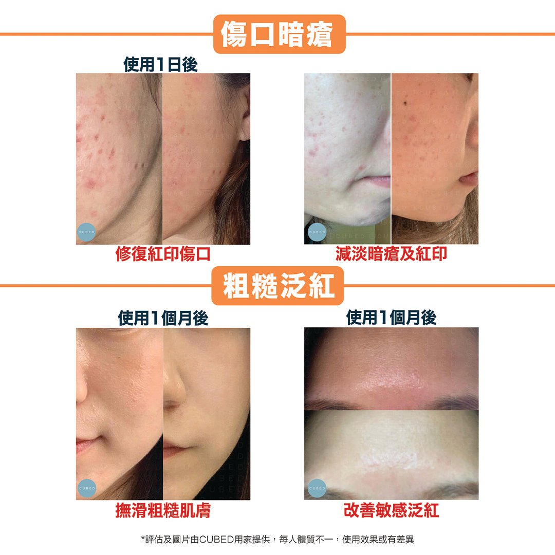 Cubed 柔膚光澤組合 - 紓緩敏感泛紅及減淡色素沉澱,美白提升光澤 | 敏感肌、暗瘡肌推薦 | 過千用家回圖證實