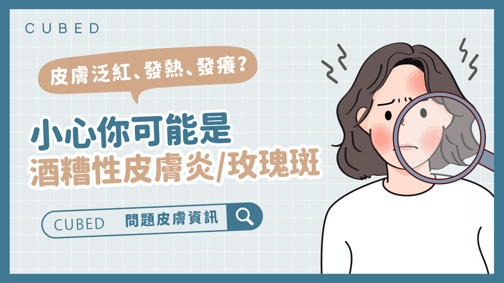 皮膚泛紅、發熱、發癢？小心你可能是酒糟性皮膚炎/玫瑰斑！