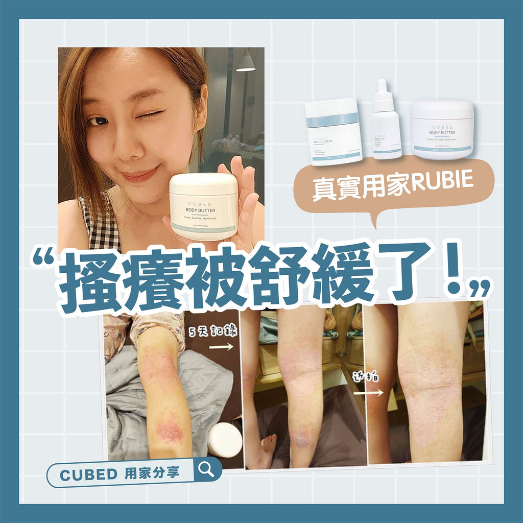 RUBIE用家分享轉載：有感的改善女兒的濕疹困擾