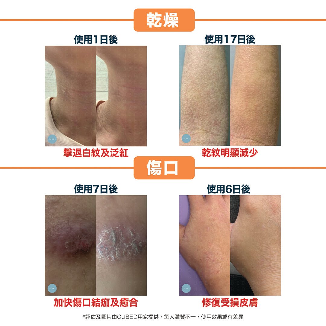 Cubed Dry Skin Therapy 乾肌修護乳液 - 日常保濕修復乾燥痕癢減淡乾紋 | 濕疹肌、敏感肌推薦  | 過千用家回圖證實