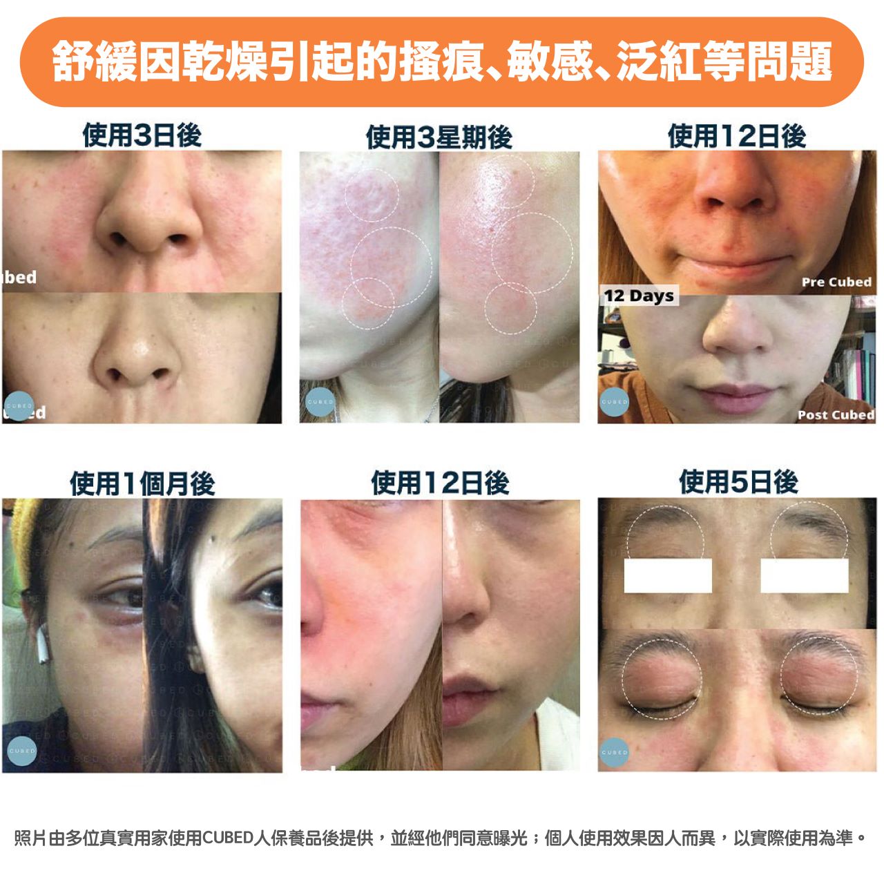 限定組合 -迷你皇牌護理組