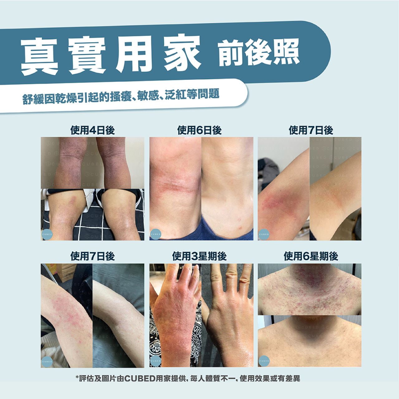 問題肌全身擊護組合