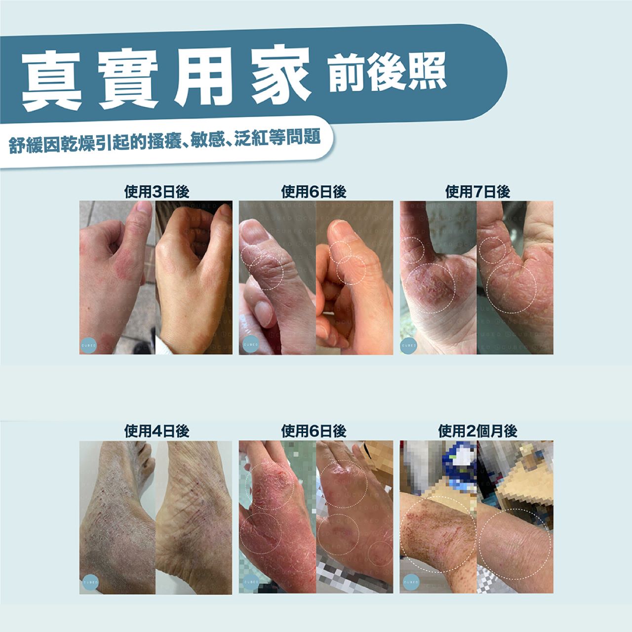 CUBED四步驟修護組（預訂：1月第4週底寄出）