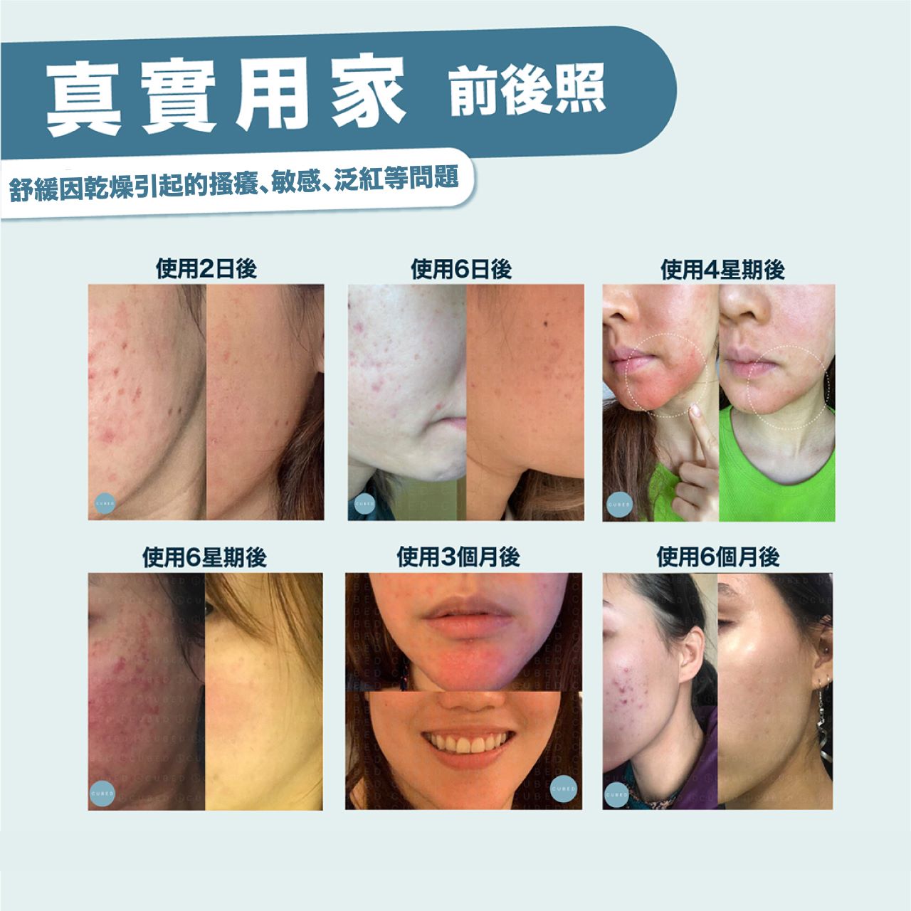 問題肌全臉擊護組合