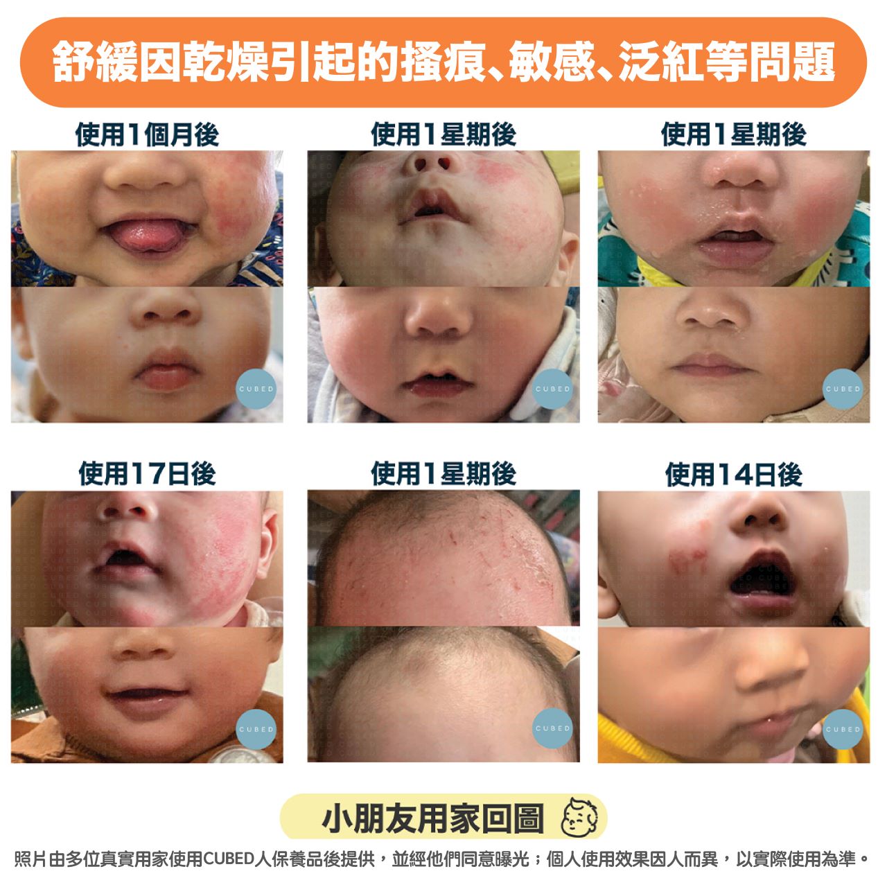 兒童紓敏潤膚霜