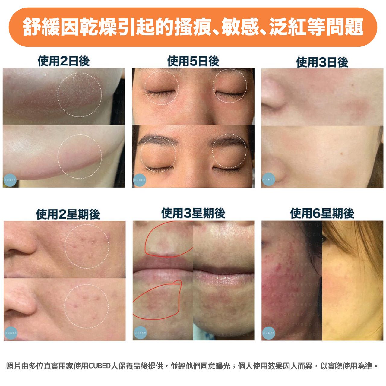 滋潤淡印去紋組合